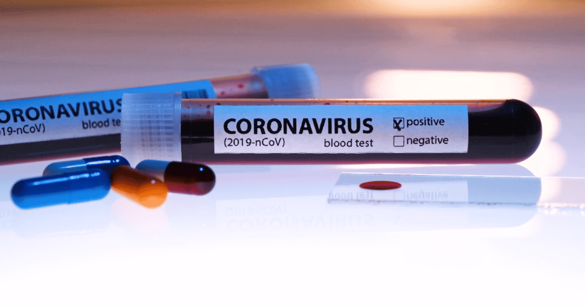 Neue Vorschriften: wer wann wie lange in Quarantäne muss | a.tv